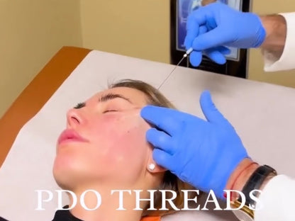 PDO Threads (NON-SURGICAL FACE LIFT)